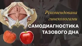 Диагностика мышц тазового дна «FIVE STEPS»