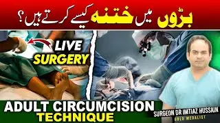 Adult Circumcision | How to do Circumcision in Adults | بڑوں میں ختنہ کرنے کا طریقہ