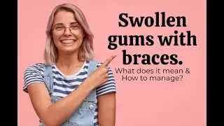 Swollen Gums With Braces. What Does It Mean?
