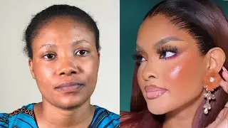 Cirugia  plastica 💉makeup transformation