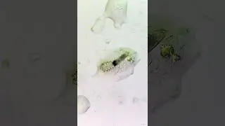 These MITES live on your FACE!