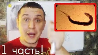 Чистка кишечника с помощью шланга – Шлангопопинг (1 часть)
