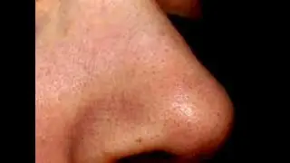 Очищающие полоски от черных точек