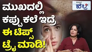 Clear Skin Face And Pimple Remove Tips | ಮುಖದಲ್ಲಿ ಕಪ್ಪು ಕಲೆ ಜಾಸ್ತಿನಾ? ತಪ್ಪದೇ ಹೀಗೆ ಮಾಡಿ!