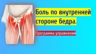 Ars синдром. Тендинит, тендинопатия приводящих мысль. Боль с внутренней стороны бедра.