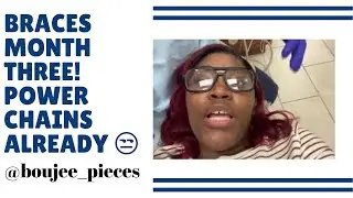 BRACES UPDATE|CLOSING MY GAP| BRACES MONTH 3