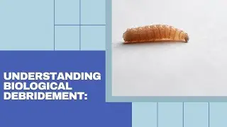Understanding Biological Debridement