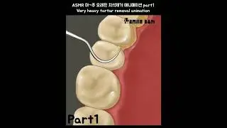 ASMR Oddly Satisfying Dirty Lashes Deep Cleaning & Stye Treatment Animation