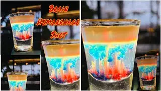 Brain Hemorrhage shot - 