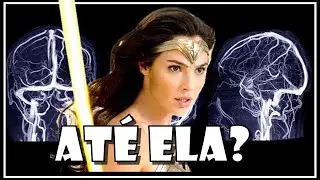 A Trombose Cerebral de Gal Gadot (Mulher-Maravilha)!