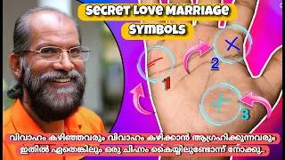 3 Secret Love Marriage Signs In You Hand ||ഈ രേഖ നിങ്ങളുടെ കൈയ്യിലുണ്ടോന്ന് നോക്കു||Palmistry Secret