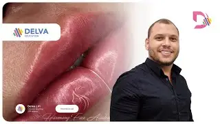 Imersão em Toxina Botulínica e Preenchimento Facial