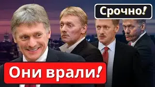 Срочно! Песков заявил про значительные потери России на Украине! Последние новости России!