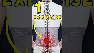 Best exercise for lower back pain #sciatica #discbulge #backpain #discbulges