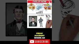 The Shocking Story of Phineas Gage's Brain Injury