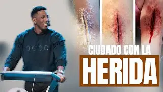 CUIDADO CON LA HERIDA | Pastor Moises Bell