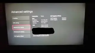 best dns for xbox one or series