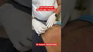 Core Activation || Gas-Acidity Treatment  #chiropractor #gas #acidity #bloating #shortsfeed #shorts