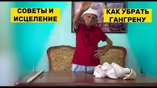 КАК ЛЕЧИТ ГАНГРЕНУ В ДОМАШНИХ УСЛОВИЯХ | Полное восстановление гангрены!