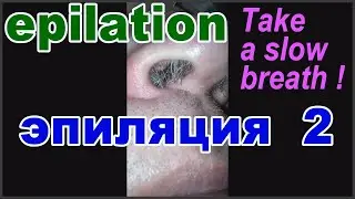 удаление волос зажигалкой