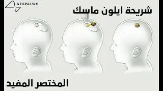 شريحة ايلون ماسك ... المختصر المفيد