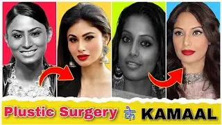 Bollywood Actresses के असली चेहरे | Shocking After Plustic Surgery