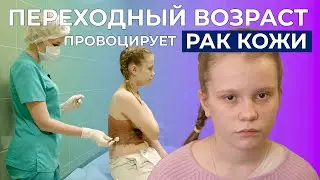 МЕЛАНОФОРМНЫЙ НЕВУС ТУЛОВИЩА I История Даши Бурдиной