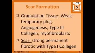 Complement System, Granulomas, Exudate Granulation Tissue C5a multinucleated giant cells