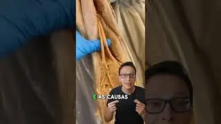 Nervo Ciático 😮🦵 