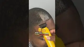 Grey HAIRLINE  Patch is Crazy 💈😅
