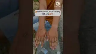 Remove Hands and Feet Tanning Instantly at home #viral #shorts