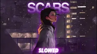 ◉ EDM | SCARS [Slowed] - WILL SPARKS & DARREN STYLES
