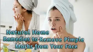 How to remove pimple acne mark from face naturally at home