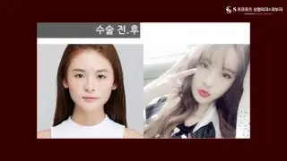 슈퍼모델의 꿈을 S프로포즈성형외과와 함께~