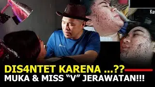 CEWEK INI DIS4NTET SAMPE MUKA DAN MISS 