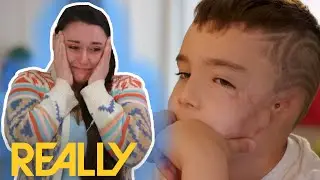 8-Year-Old Boy Gets New Prosthetic Ears After Dog Attack | Body Parts