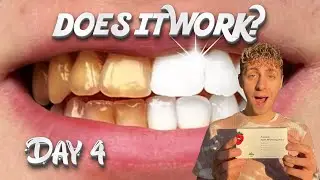 Testing our the ‘viral’ TEETH WHITENING STRIPS (Day4)