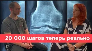 Заклинил коленный сустав. Лечение боли в ноге и колене. Отзыв MIOFIX