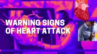 Warning Signs of Heart Attack