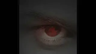 Яйцо в жопе))