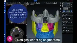Oplev fordelene med Romexis®