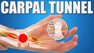 How to FIX Hand Pain from Carpal Tunnel Syndrome.  Best Stretches, Exercises & Treatments