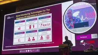 Optimizing Home Tool Monitoring to Detect Arrhythmias