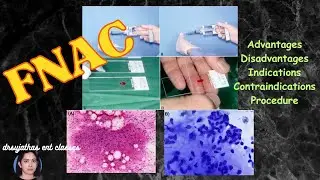 237.Fine Needle Aspiration Biopsy - fine needle aspiration cytology (fnac) #surgeryeducation #fnac