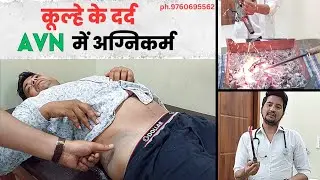 कूल्हे के दर्द AVN में अग्निकर्म से दर्द खत्म | Dr.Amit Bharti