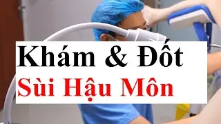 Perform Clinical Examination & Burn Genital Warts (HPV) Using Electric Knife Method At Doctor Sac