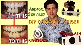 How To Make DIY Cross Polariser Filter At Home For Dental Photography (Ring Flash and Twin Flash)