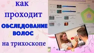 Как проходит обследование волос на трихоскопе