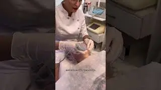 Ультразвуковая чистка лица 