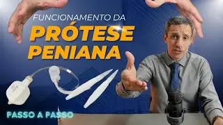 Funcionamento de uma PRÓTESE PENIANA INFLÁVEL passo a passo - Dr Heleno Paes